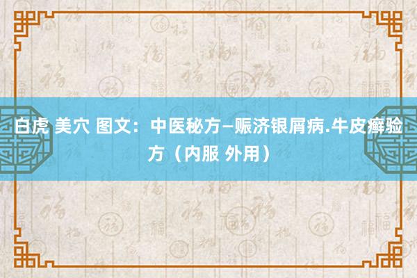 白虎 美穴 图文：中医秘方—赈济银屑病.牛皮癣验方（内服 外用）